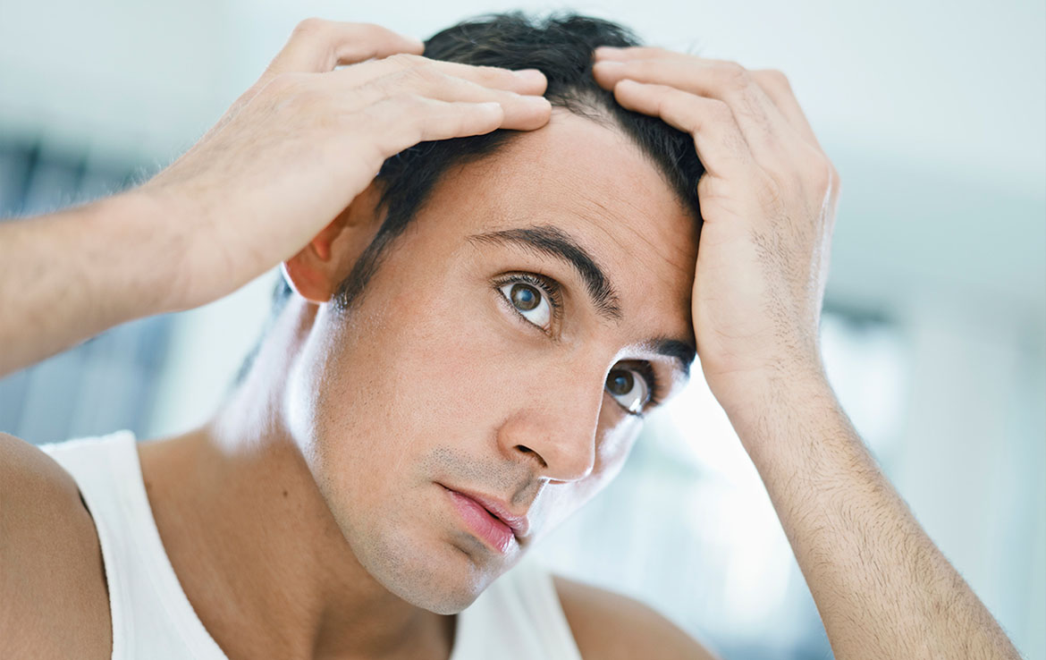 Before Getting a Hair Transplant